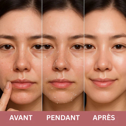 Peel Shot coréen – Désobstrue les pores, lisse la peau et ravive l’éclat du teint