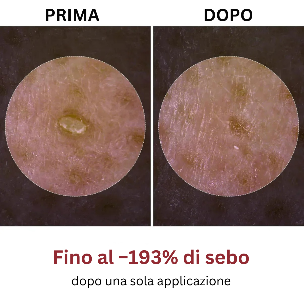 Peel Shot coreano – Libera i pori, leviga la pelle e ravviva la luminosità