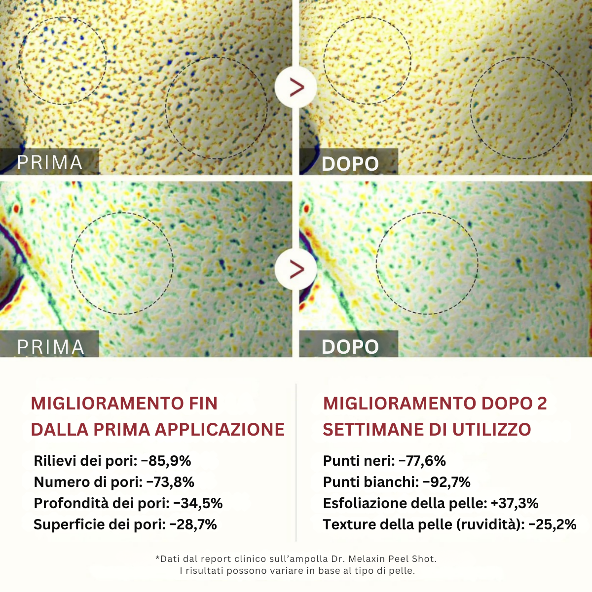 Peel Shot coreano – Libera i pori, leviga la pelle e ravviva la luminosità
