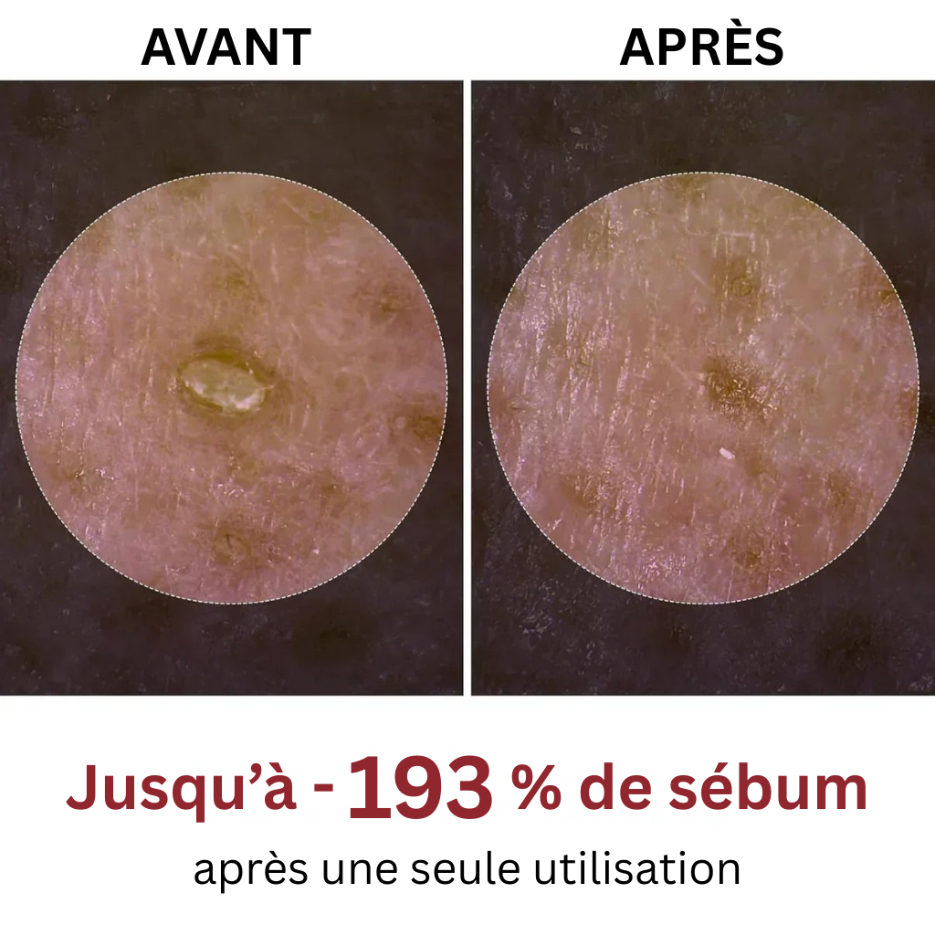 Peel Shot coréen – Désobstrue les pores, lisse la peau et ravive l’éclat du teint
