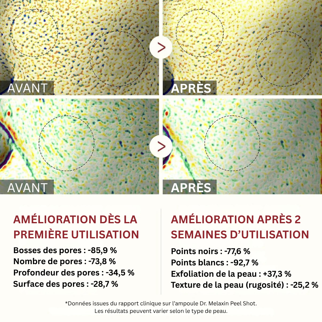 Peel Shot coréen – Désobstrue les pores, lisse la peau et ravive l’éclat du teint