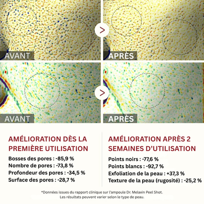 Peel Shot coréen – Désobstrue les pores, lisse la peau et ravive l’éclat du teint